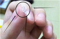  502膠水把手黏住了怎么辦?